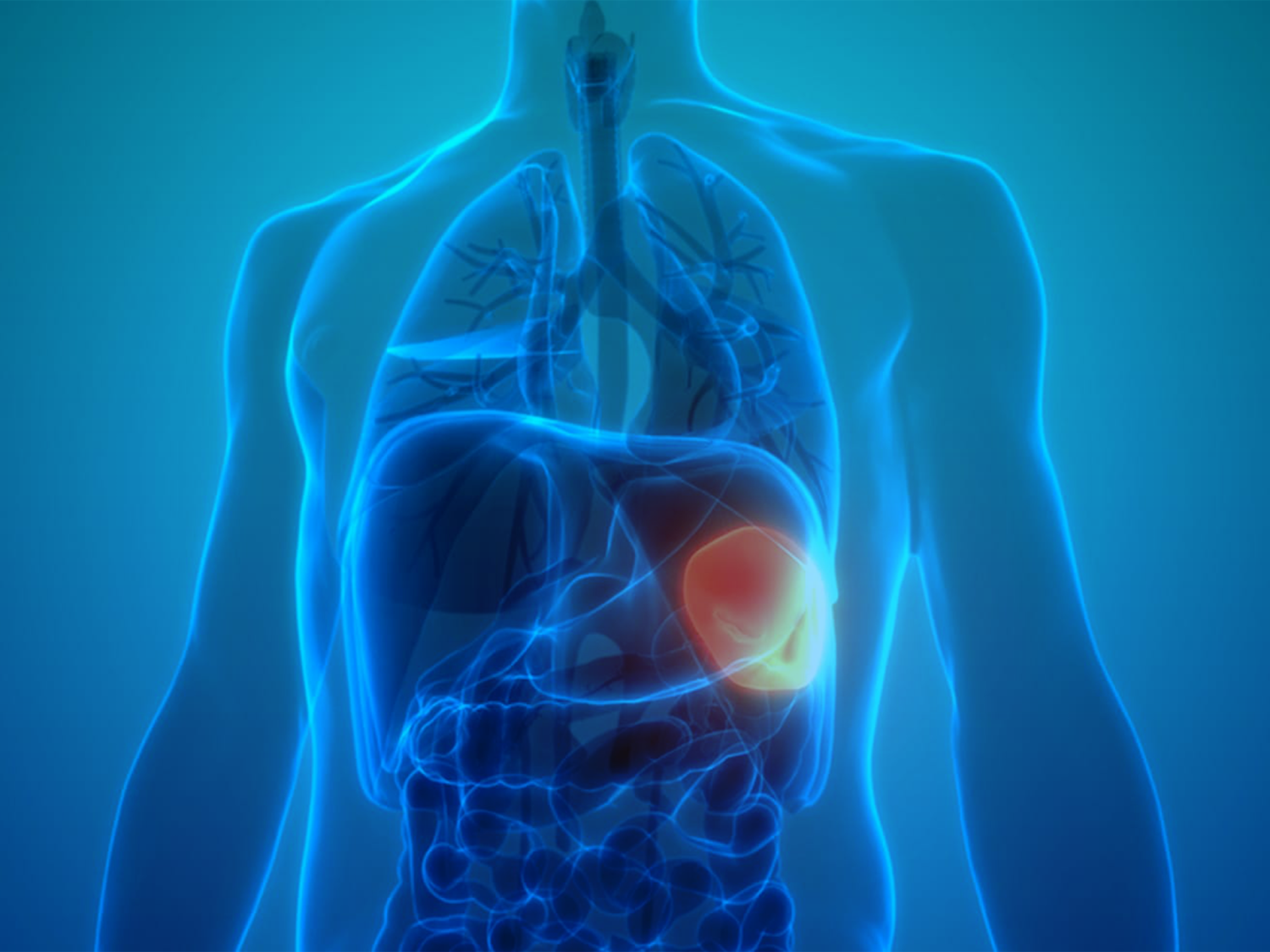 استصال-الطحال