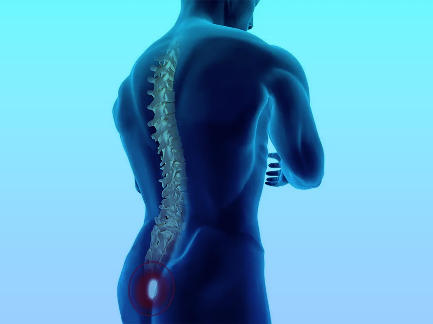 الناسور-العصعصي